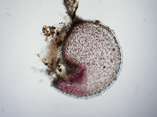 Utricularia monanthos - Fangblase